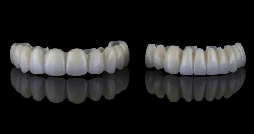 Tam ağız diş implantı tedavisi avantajları - Antalya Tam ağız diş implantı avantajları Antalya
