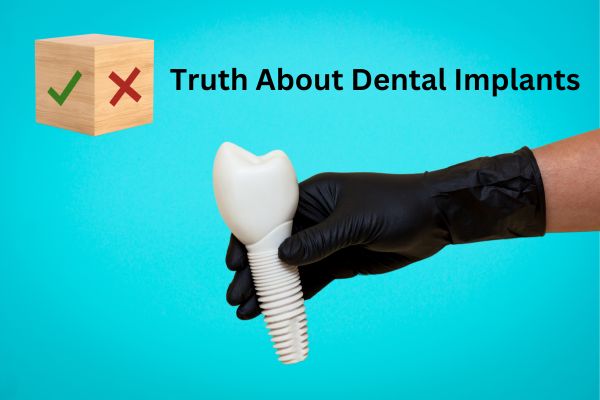 truth-about-dental-implants