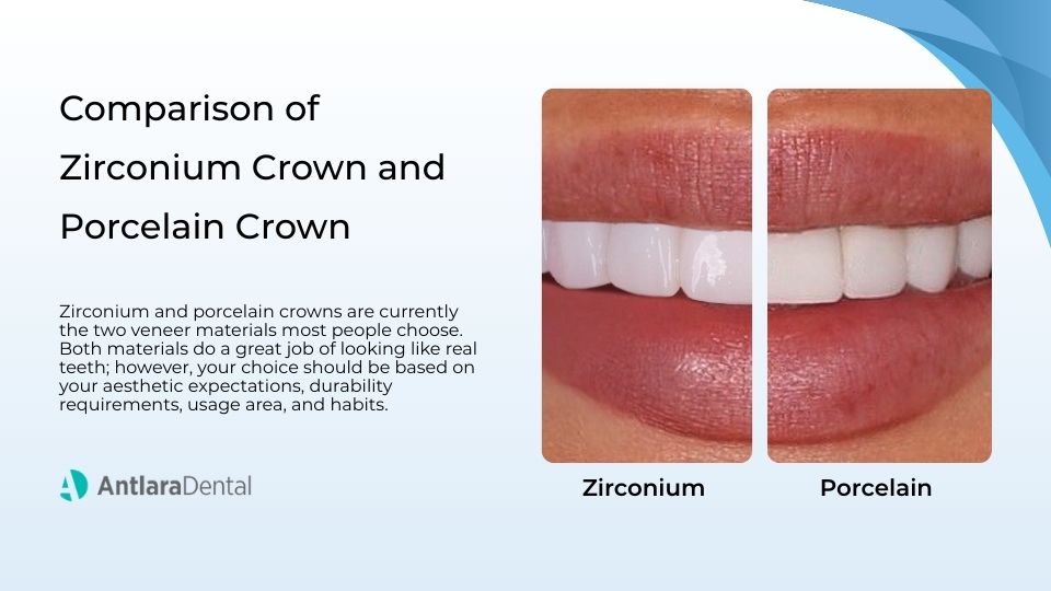 Zirconium Crowns and Porcelain Crowns: Which Is Better? Zirconium Crowns and Porcelain Crowns: Which Is Better?