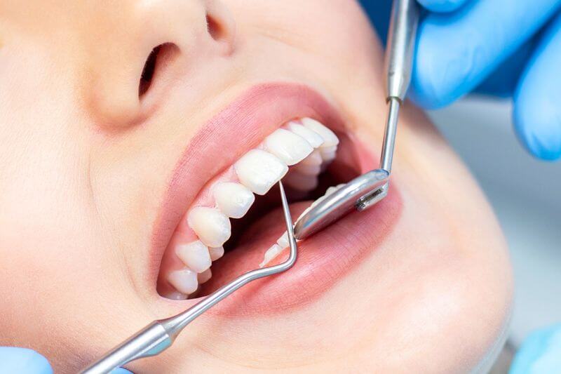 women opening her mouth with a beautiful teeth and dentist operating Deep Dental Cleaning