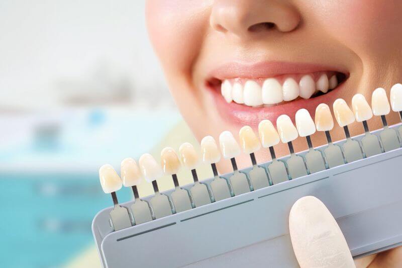 a pretty women choosing typrs of veneers before dental veneers treatment in turkey