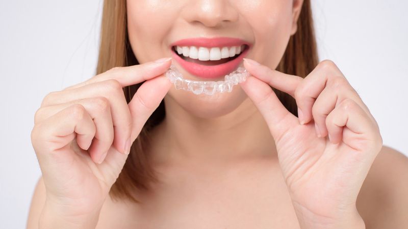 Frauen halten Invisalign-Zähne und lächeln