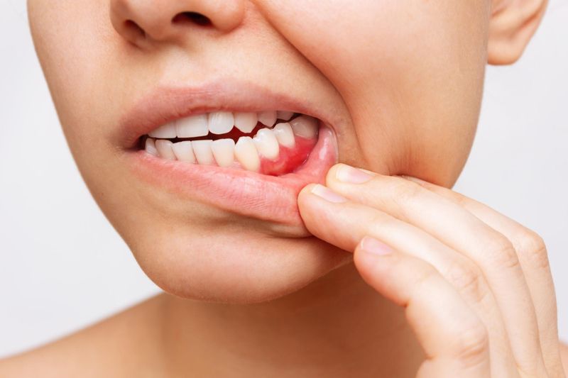 a women show her teeth that has Periodontal teeth problems 