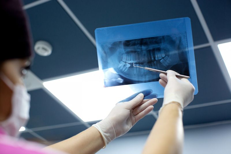 in dental clinic Turkey a doctor examine the patient teeth that needs Periodontal Treatments